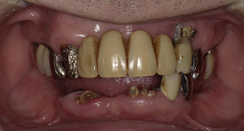 Before
