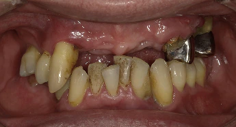 Before