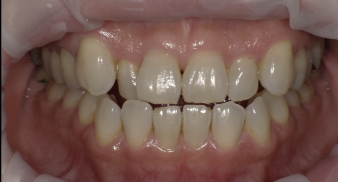Before