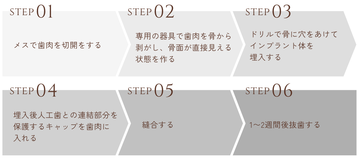 step01メスで歯肉を切開をする step02専用の器具で歯肉を骨から剥がし、骨面が直接見える状態を作る step03ドリルで骨に穴をあけてインプラント体を埋入する step04埋入後人工歯との連結部分を保護するキャップを歯肉に入れる step05縫合する step061〜2週間後抜歯する