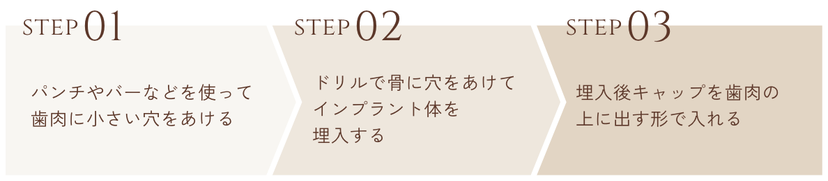 step01パンチやバーなどを使って歯肉に小さい穴をあける step02ドリルで骨に穴をあけてインプラント体を埋入する step03埋入後キャップを歯肉の上に出す形で入れる