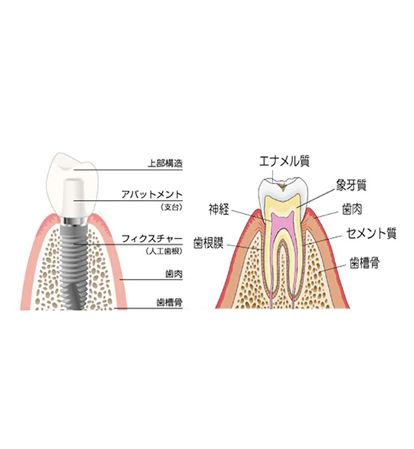 早めの治療がとても大切です